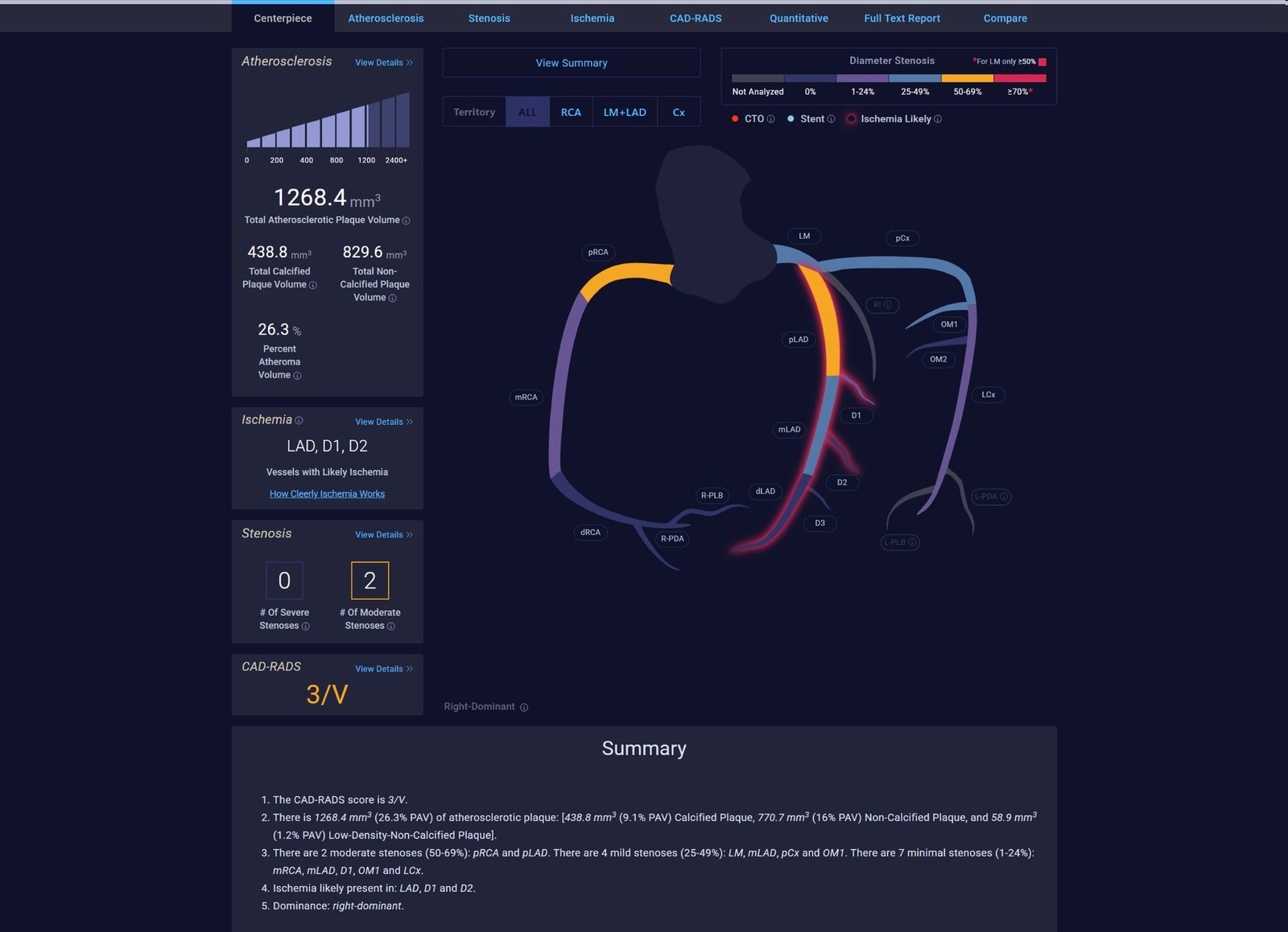 Cleerly scan report dashboard showing total atherosclerotic plaque volume, calcified and non-calcified plaque breakdown, percent atheroma volume, stenosis counts, CAD-RADS score and a colour-coded map of the coronary arteries