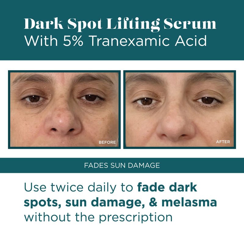 VI Derm Dark Spot Lifting Serum bottle